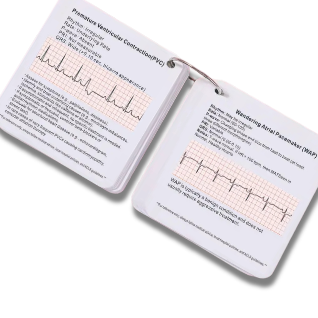 42 ECG Rhythm &amp; Arrhythmia Flashcards – Nursing & Medical Student ECG Reference Tool