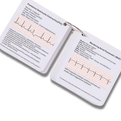 42 ECG Rhythm &amp; Arrhythmia Flashcards – Nursing & Medical Student ECG Reference Tool