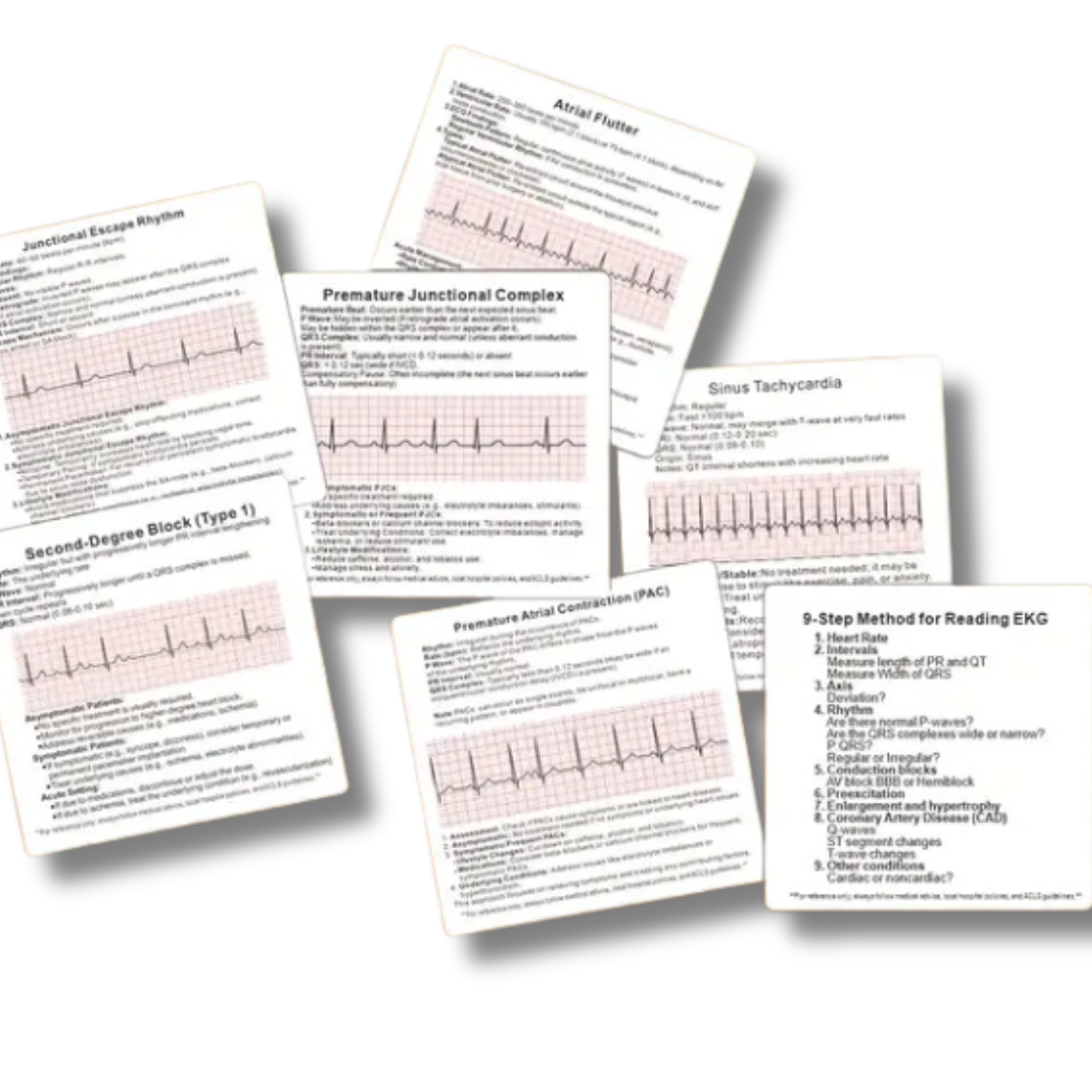 42 ECG Rhythm &amp; Arrhythmia Flashcards – Nursing & Medical Student ECG Reference Tool